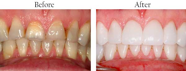 Temple dental images