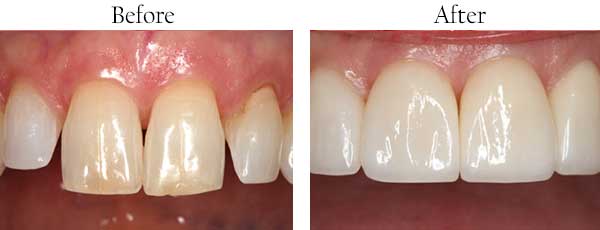 Temple dental images
