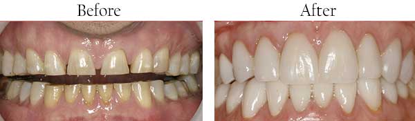 dental images 76504